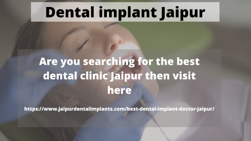 Dental implant Jaipur
