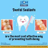 Dental-Sealants-Jaipur-Dental-Hospital-Jai-Jinendra